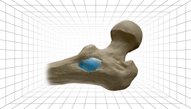 hydrogel illustration scaffolds