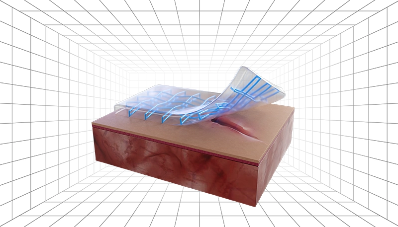 hydrogel illustration wound healing